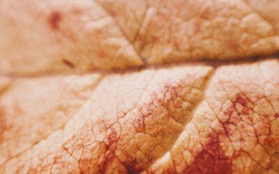 Urticaire, eczéma : de la peau au cerveau